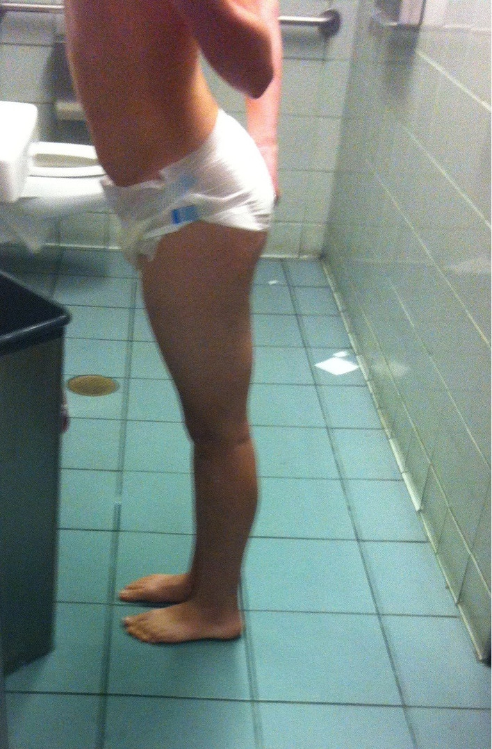 Why does my diaper feel funny? - Imgur