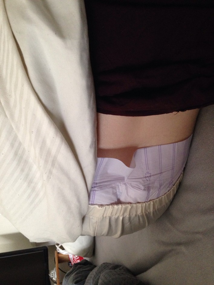 Diapers of Denmark — What’s that underneath her pyjamas ?